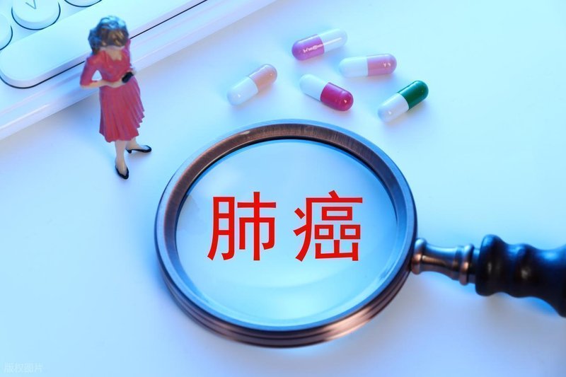  肺癌为何“伪装”成肩痛：神经解剖学视角下的牵涉痛机制深度解析 健康养生